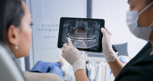 Licensed Tooth Extraction service in Cleveland, TX - Smile Center Dentistry
